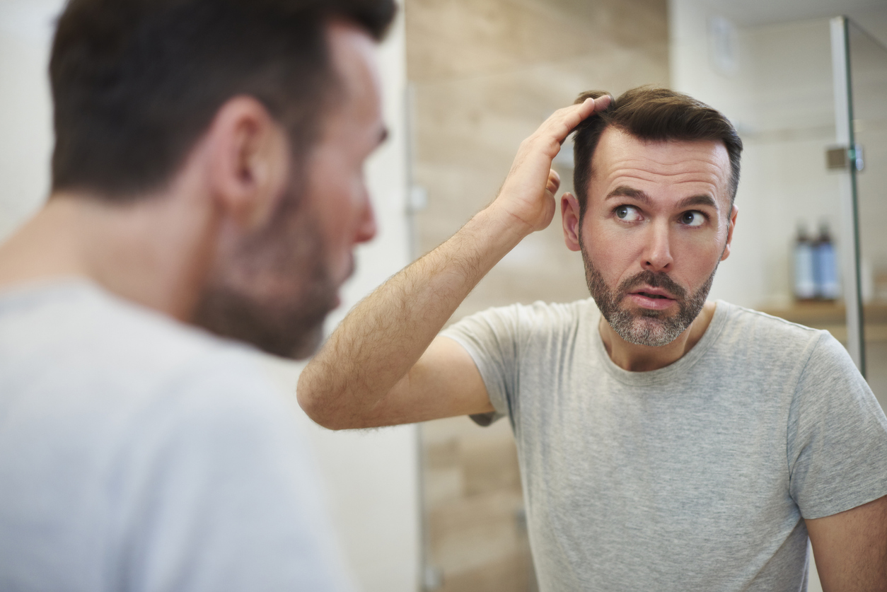 Hair loss in men: What you need to know about losing your hair - MBman