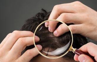 Prevent hair loss men