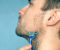 Ingrown-hair-removal-get-rid