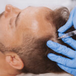 Best hair loss treatment for men UK